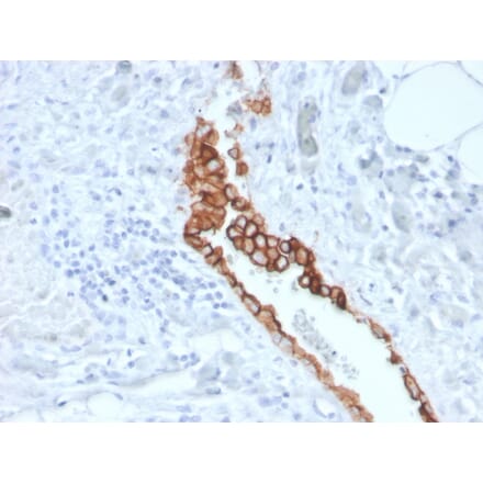 Immunohistochemistry - Anti-Mesothelin Antibody [MSLN/3387] (A248082) - Antibodies.com