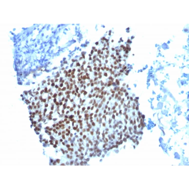 Immunohistochemistry - Anti-p21 Antibody [WA-1] (A248082) - Antibodies.com