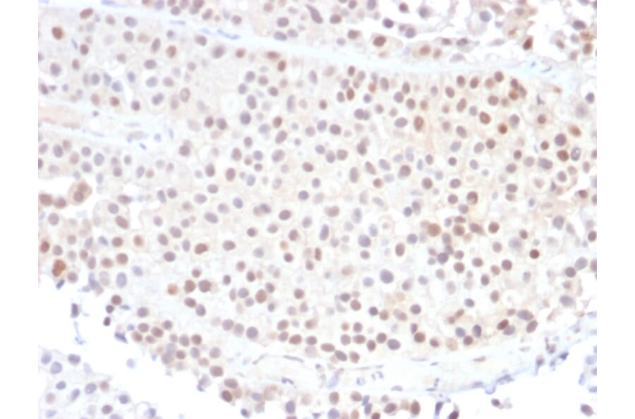 Immunohistochemistry - Anti-p21 Antibody [DCS-60.2] (A248083) - Antibodies.com