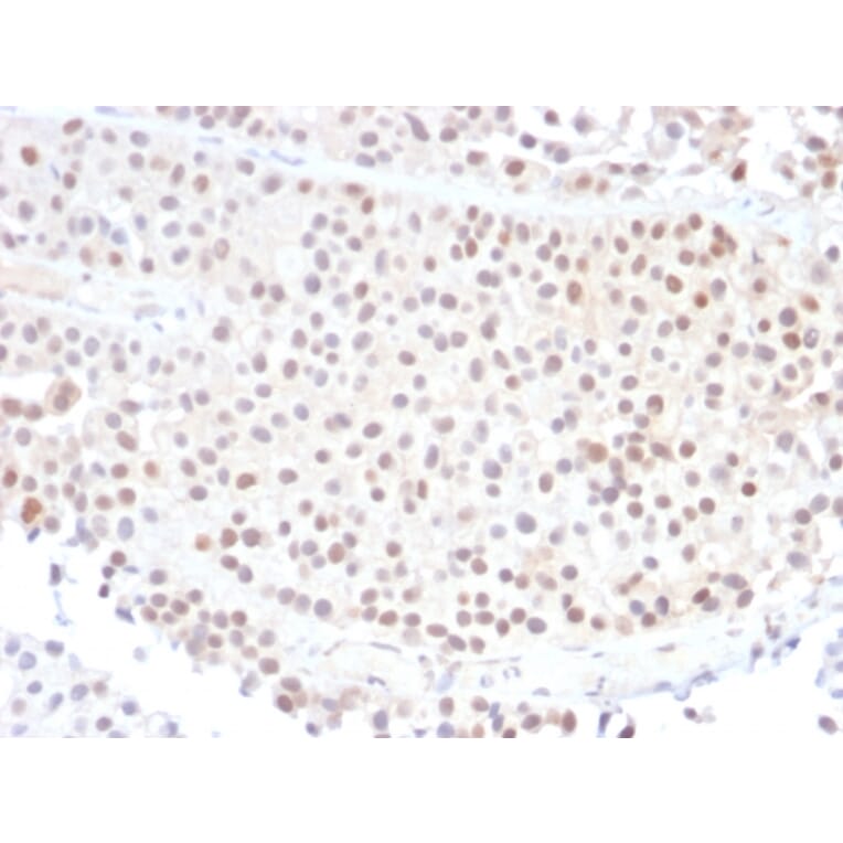 Immunohistochemistry - Anti-p21 Antibody [DCS-60.2] (A248083) - Antibodies.com