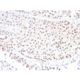 Immunohistochemistry - Anti-p21 Antibody [DCS-60.2] (A248083) - Antibodies.com