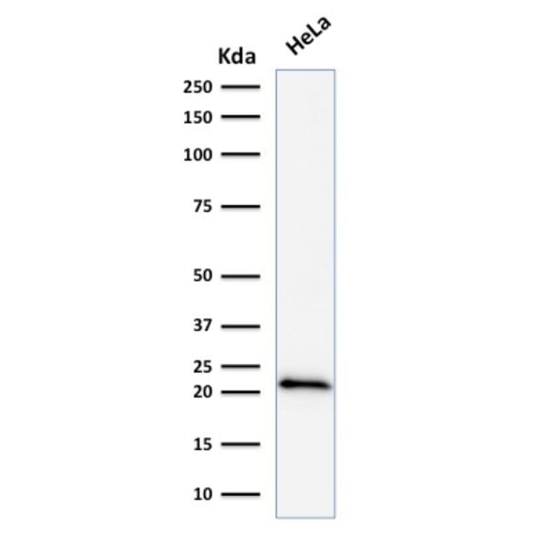 Western Blot - Anti-p21 Antibody [DCS-60.2] (A248084) - Antibodies.com