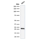 Western Blot - Anti-p21 Antibody [DCS-60.2] (A248084) - Antibodies.com