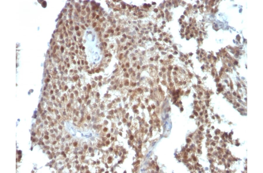 Immunohistochemistry - Anti-p21 Antibody [SPM306] (A248084) - Antibodies.com