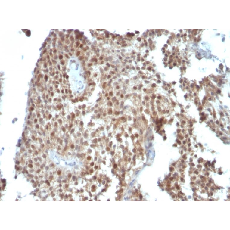 Immunohistochemistry - Anti-p21 Antibody [SPM306] (A248084) - Antibodies.com