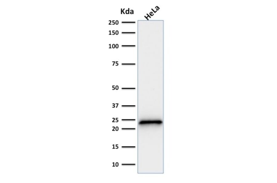 Western Blot - Anti-p21 Antibody [SPM306] (A248085) - Antibodies.com