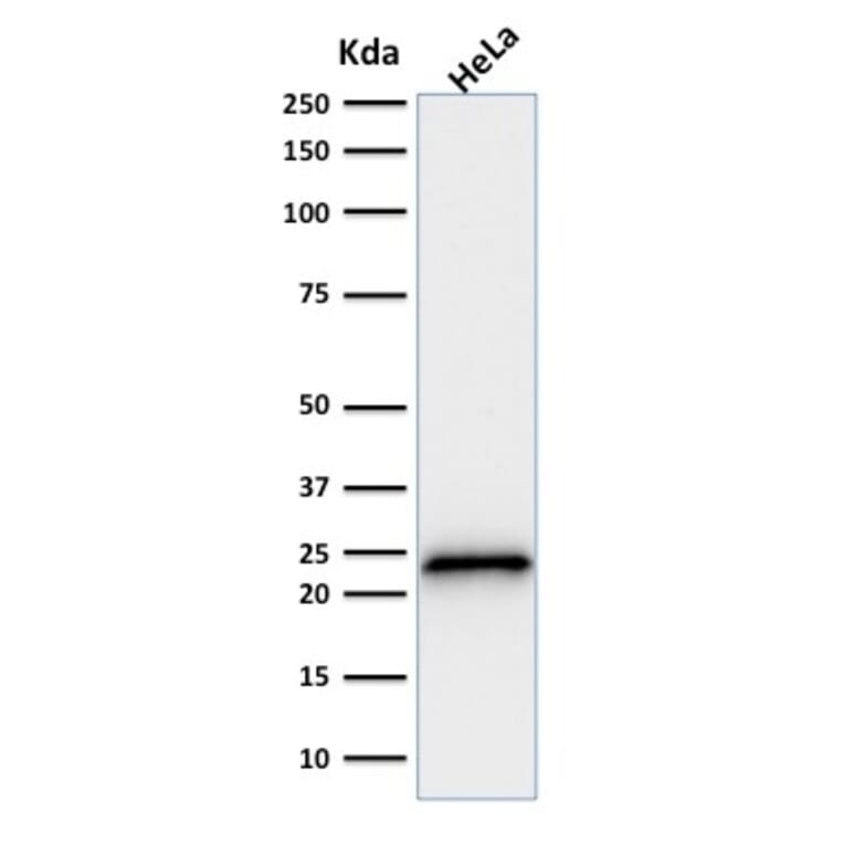 Western Blot - Anti-p21 Antibody [SPM306] (A248085) - Antibodies.com