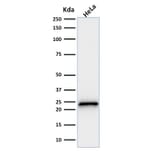 Western Blot - Anti-p21 Antibody [SPM306] (A248085) - Antibodies.com