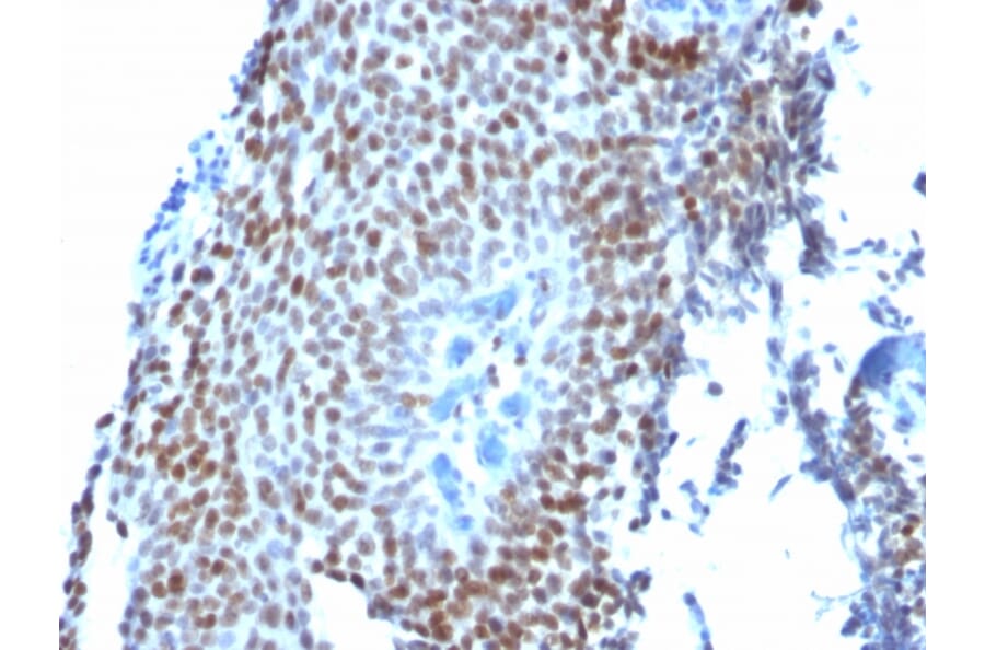 Immunohistochemistry - Anti-p21 Antibody [CIP1/823] (A248086) - Antibodies.com
