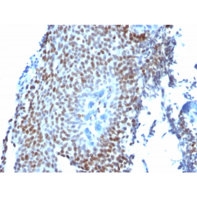 Immunohistochemistry - Anti-p21 Antibody [CIP1/823] (A248086) - Antibodies.com