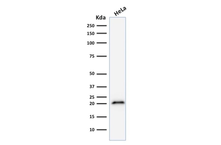 Western Blot - Anti-p21 Antibody [CIP1/823] (A248086) - Antibodies.com