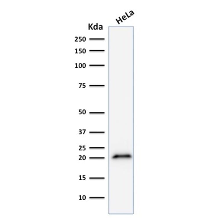 Western Blot - Anti-p21 Antibody [CIP1/823] (A248086) - Antibodies.com