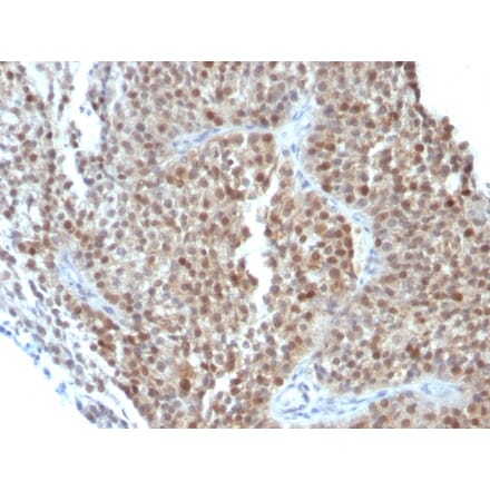 Immunohistochemistry - Anti-p21 Antibody [CIP1/823 + DCS-60.2] (A248087) - Antibodies.com
