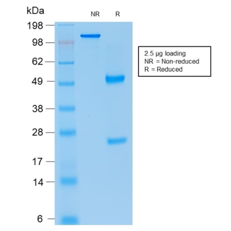 SDS-PAGE - Anti-p21 Antibody [rCIP1/823] (A248089) - Antibodies.com