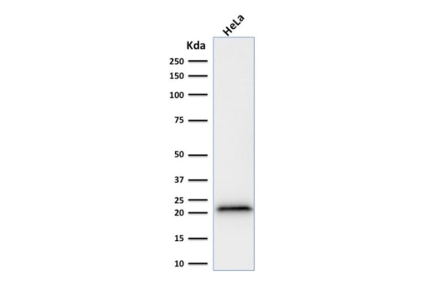 Western Blot - Anti-p21 Antibody [rCIP1/823] (A248089) - Antibodies.com