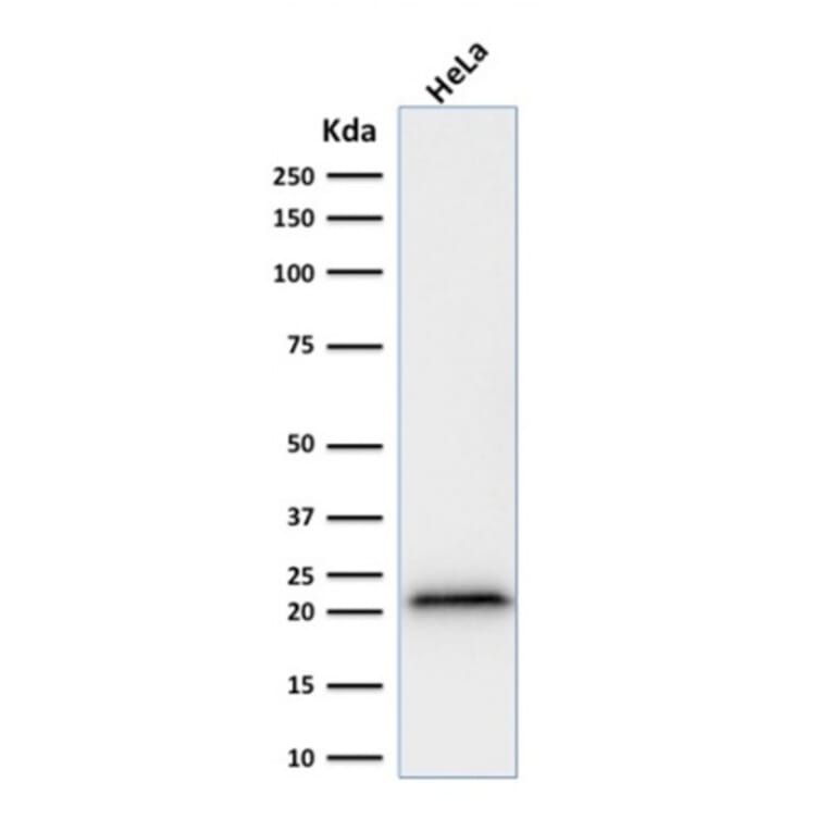 Western Blot - Anti-p21 Antibody [rCIP1/823] (A248089) - Antibodies.com