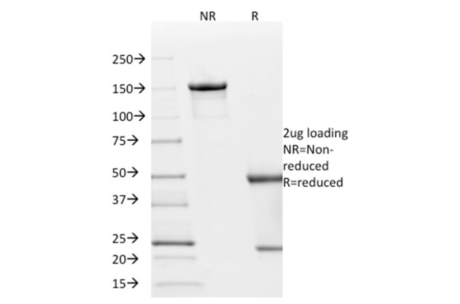 SDS-PAGE - Anti-p21 Antibody [AC8] (A248089) - Antibodies.com