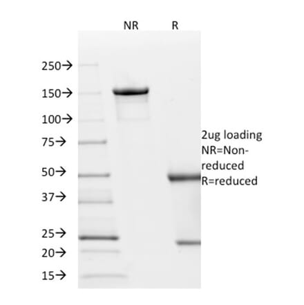 SDS-PAGE - Anti-p21 Antibody [AC8] (A248089) - Antibodies.com