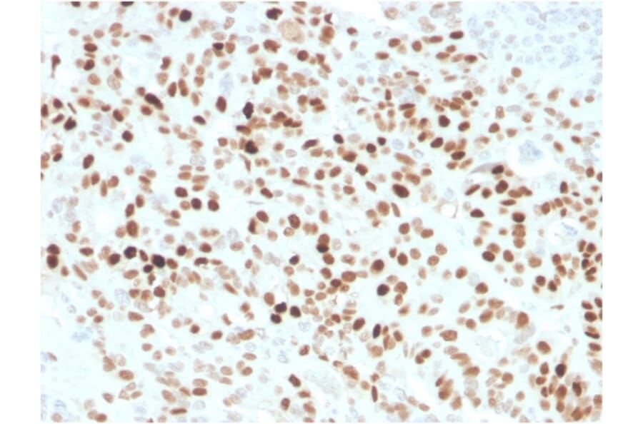 Immunohistochemistry - Anti-p21 Antibody [CIP1/4377R] (A248091) - Antibodies.com