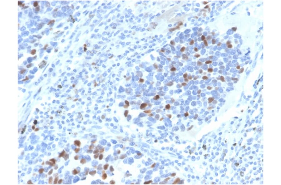 Immunohistochemistry - Anti-p21 Antibody [CIP1/4377R] (A248091) - Antibodies.com