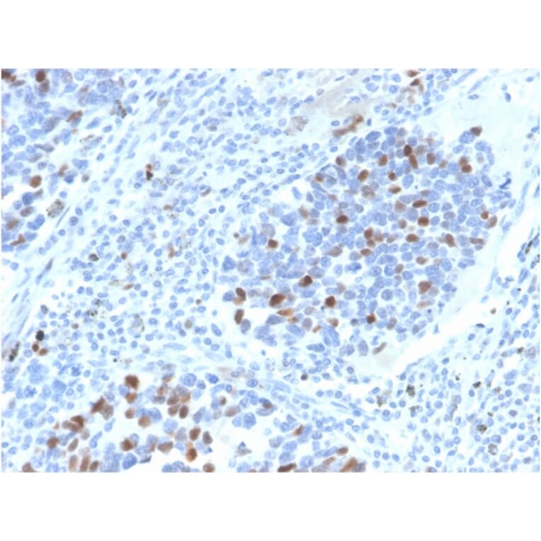 Immunohistochemistry - Anti-p21 Antibody [CIP1/4377R] (A248091) - Antibodies.com