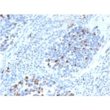 Immunohistochemistry - Anti-p21 Antibody [CIP1/4377R] (A248091) - Antibodies.com