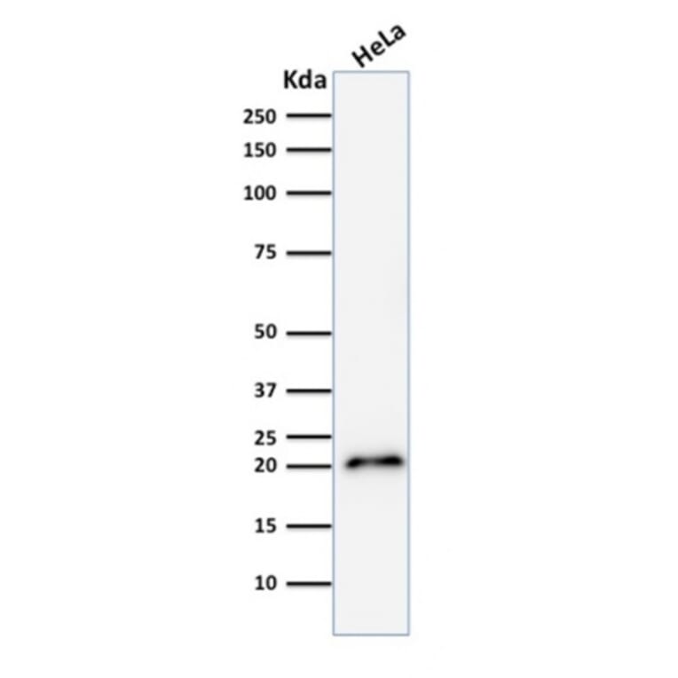 Western Blot - Anti-p21 Antibody [CIP1/2275R] (A248092) - Antibodies.com