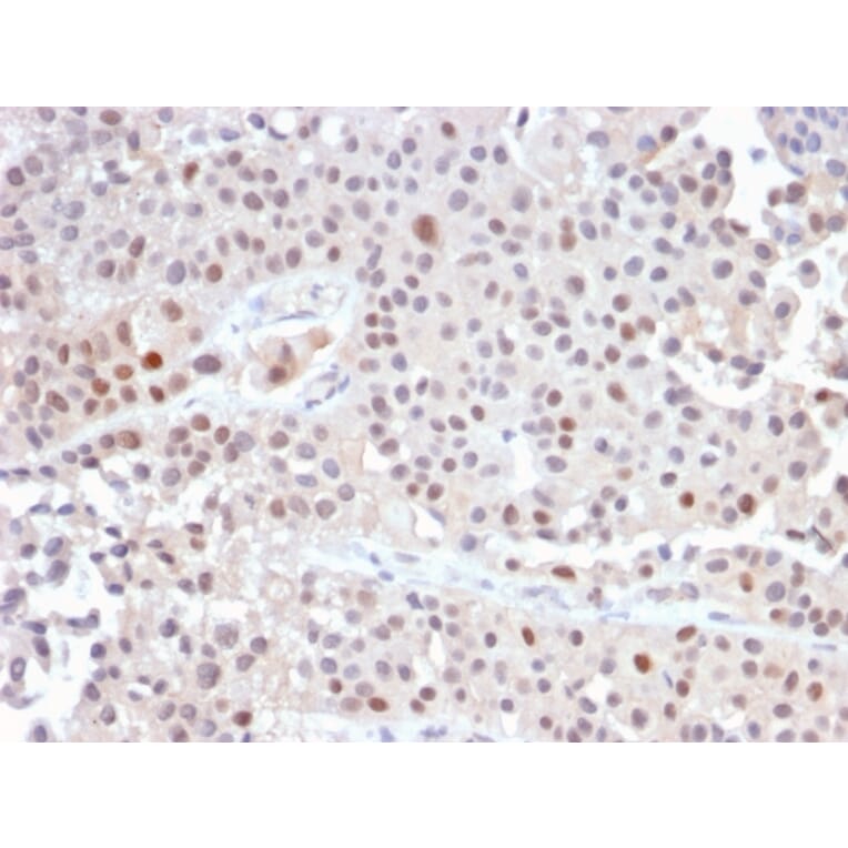 Immunohistochemistry - Anti-p21 Antibody [CIP1/2489R] (A248092) - Antibodies.com