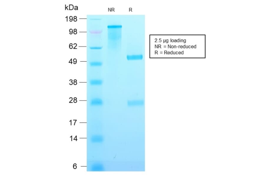 SDS-PAGE - Anti-p21 Antibody [CIP1/2489R] (A248093) - Antibodies.com
