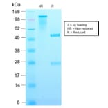 SDS-PAGE - Anti-p21 Antibody [CIP1/2489R] (A248093) - Antibodies.com