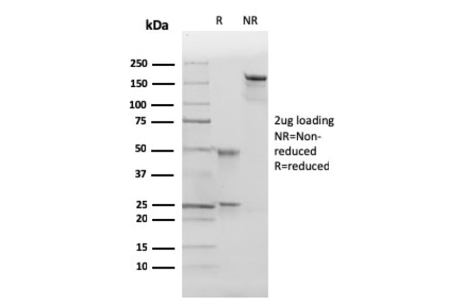 SDS-PAGE - Anti-p27 KIP 1 Antibody [SX53G8] (A248094) - Antibodies.com