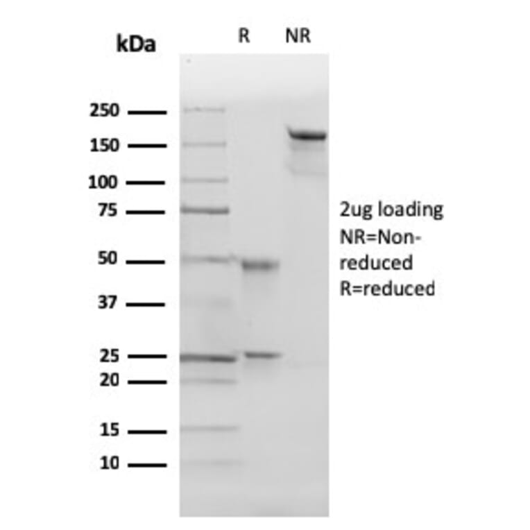 SDS-PAGE - Anti-p27 KIP 1 Antibody [SX53G8] (A248094) - Antibodies.com