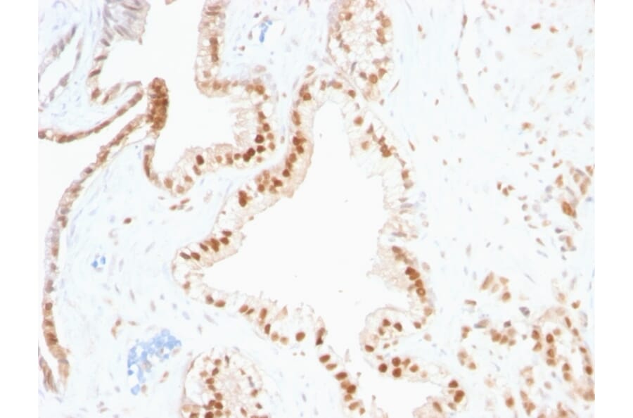 Immunohistochemistry - Anti-p27 KIP 1 Antibody [SPM348] (A248095) - Antibodies.com