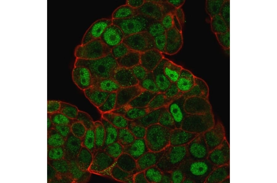 Immunofluorescence - Anti-p27 KIP 1 Antibody [SPM348] (A248094) - Antibodies.com