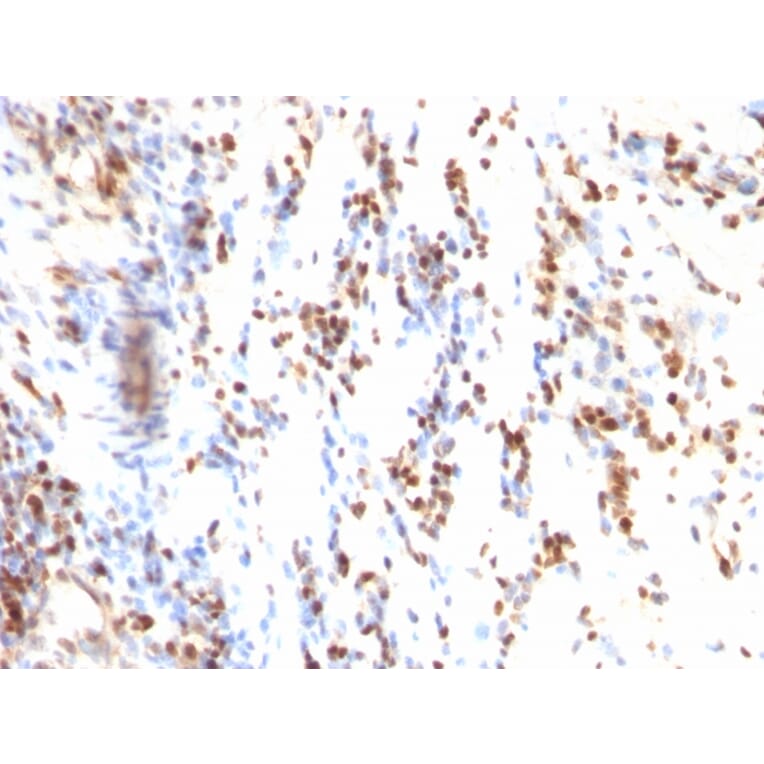 Immunohistochemistry - Anti-p27 KIP 1 Antibody [KIP1/769] (A248096) - Antibodies.com