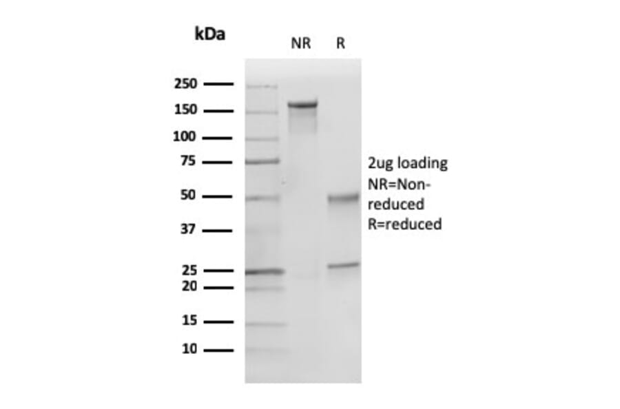 SDS-PAGE - Anti-p27 KIP 1 Antibody [KIP1/769] (A248096) - Antibodies.com
