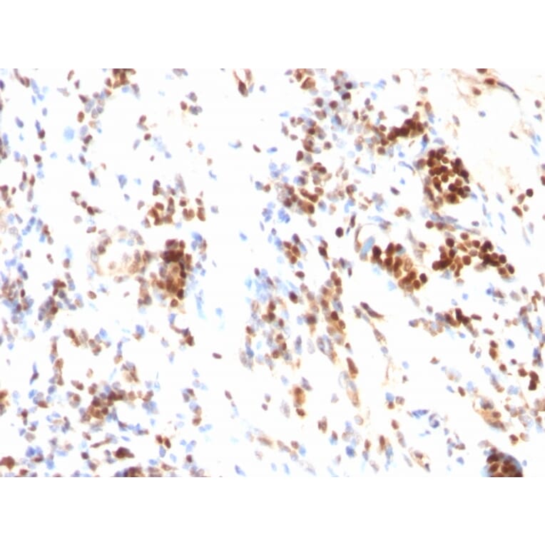 Immunohistochemistry - Anti-p27 KIP 1 Antibody [DCS-72.F6] (A248097) - Antibodies.com