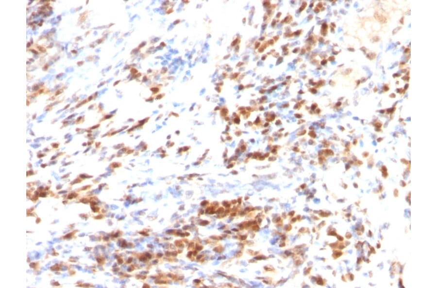 Immunohistochemistry - Anti-p27 KIP 1 Antibody [DCS-72.F6 + KIP1/769] (A248097) - Antibodies.com