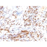 Immunohistochemistry - Anti-p27 KIP 1 Antibody [DCS-72.F6 + KIP1/769] (A248097) - Antibodies.com