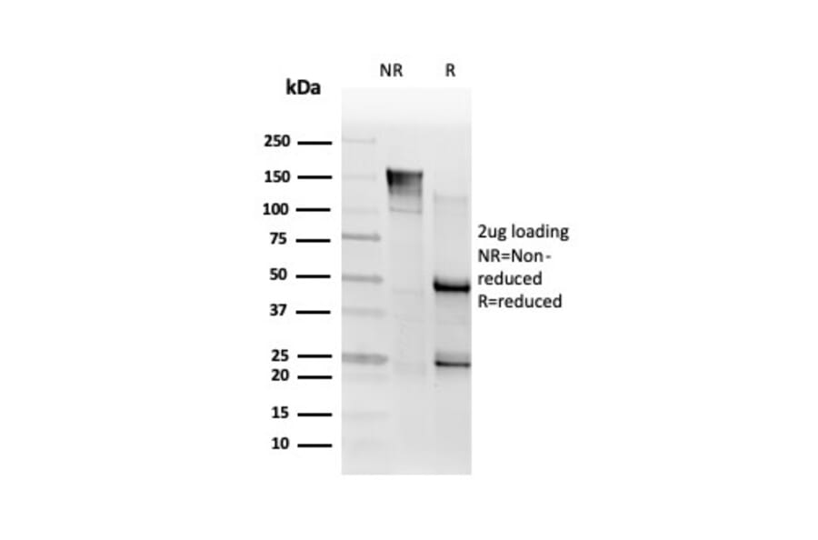 SDS-PAGE - Anti-SMNDC1 Antibody [PCRP-SMNDC1-1A9] (A248099) - Antibodies.com
