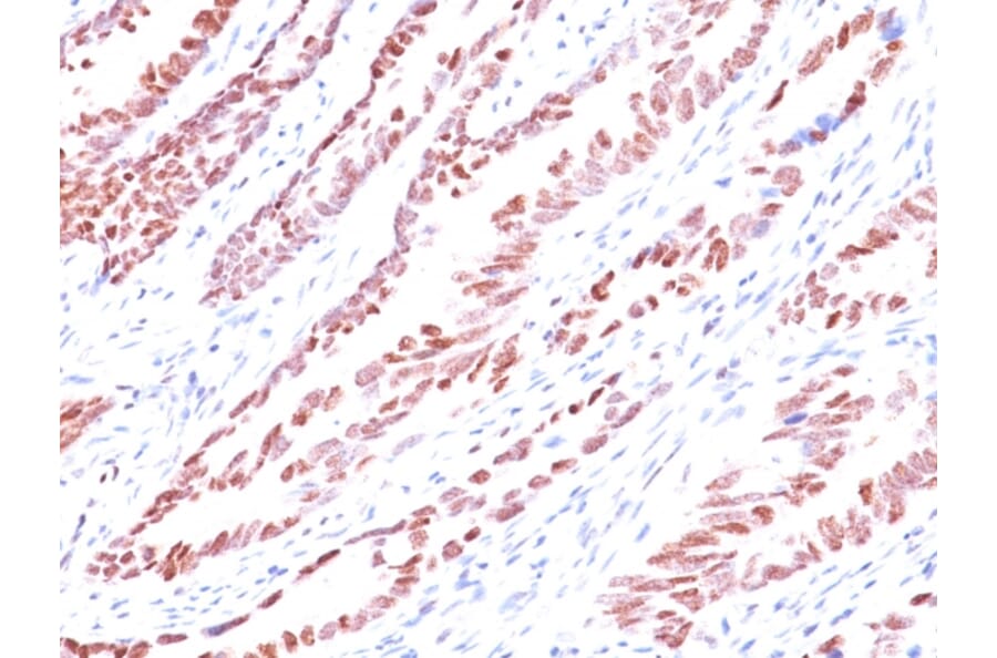 Immunohistochemistry - Anti-p57 Kip2 Antibody [KP10] (A248099) - Antibodies.com
