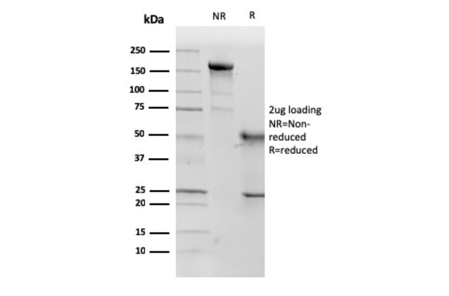 SDS-PAGE - Anti-p57 Kip2 Antibody [KP10] (A248100) - Antibodies.com