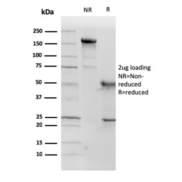 SDS-PAGE - Anti-p57 Kip2 Antibody [KP10] (A248100) - Antibodies.com