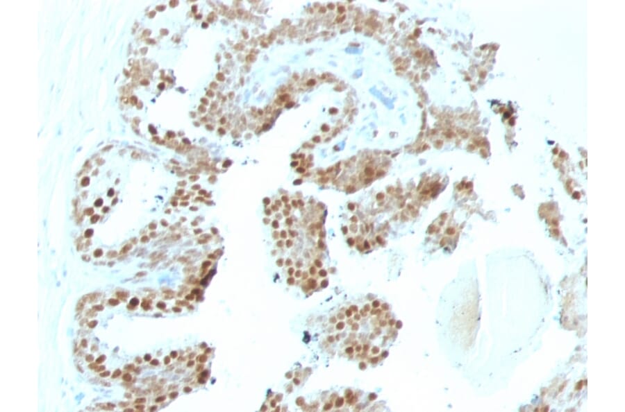 Immunohistochemistry - Anti-p57 Kip2 Antibody [SPM308] (A248100) - Antibodies.com