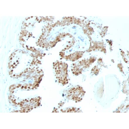 Immunohistochemistry - Anti-p57 Kip2 Antibody [SPM308] (A248100) - Antibodies.com