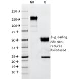 SDS-PAGE - Anti-p57 Kip2 Antibody [SPM308] (A248101) - Antibodies.com