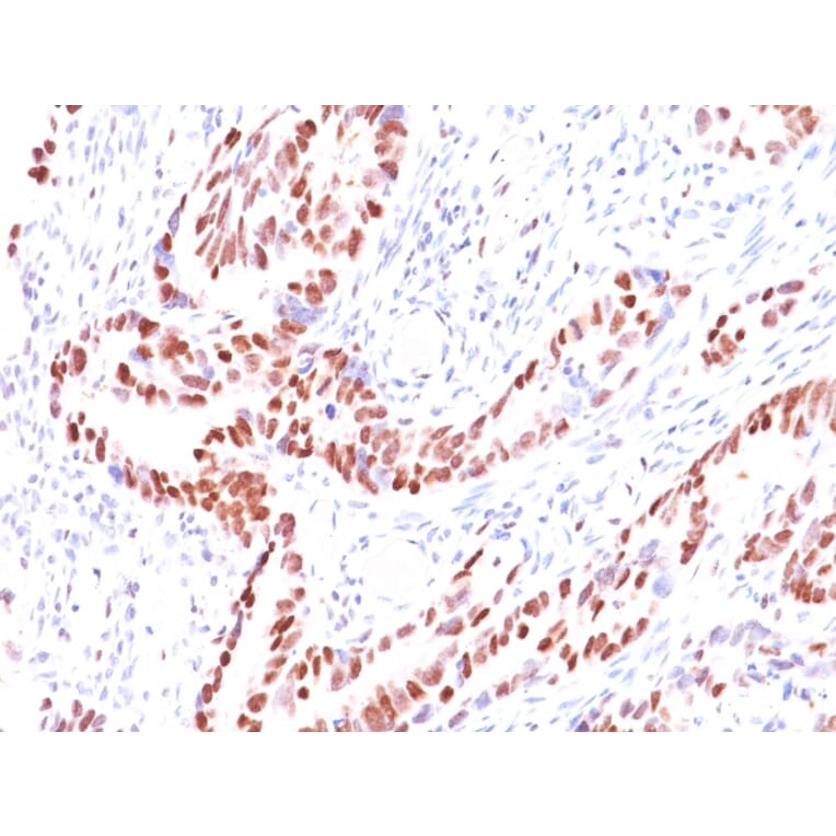 Immunohistochemistry - Anti-p57 Kip2 Antibody [KIP2/880] (A248101) - Antibodies.com