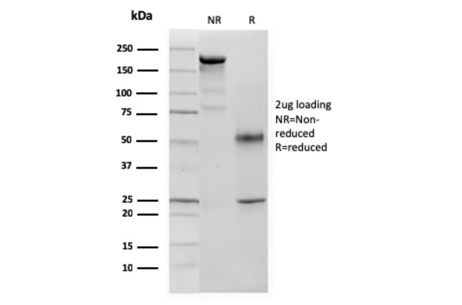 SDS-PAGE - Anti-p57 Kip2 Antibody [KIP2/880] (A248102) - Antibodies.com