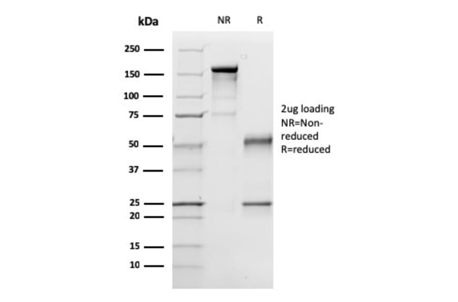 SDS-PAGE - Anti-p57 Kip2 Antibody [57P06] (A248103) - Antibodies.com