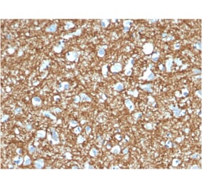 Immunohistochemistry - Anti-p14ARF Antibody [4C6/4] (A248103) - Antibodies.com